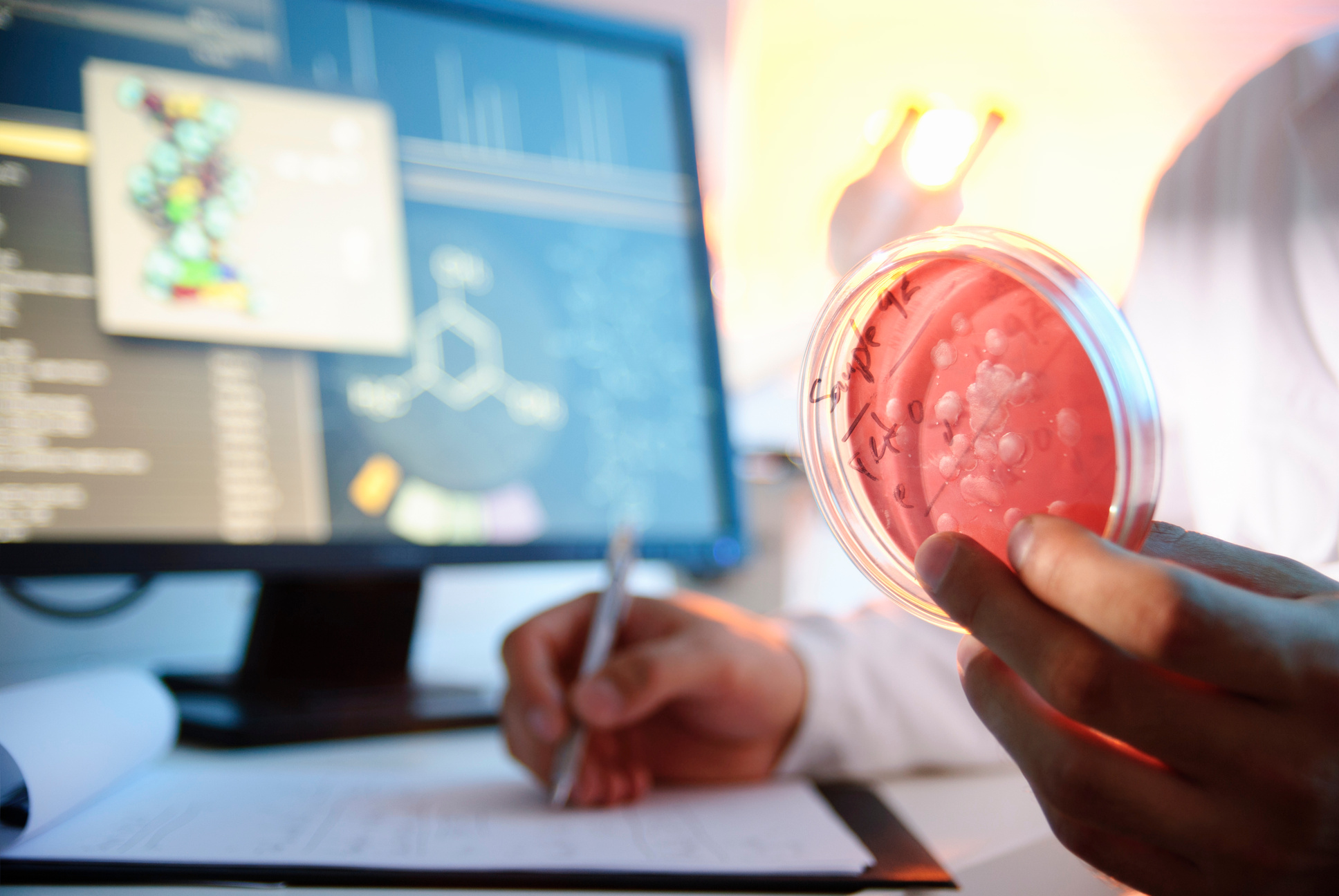 Microbiological Culture